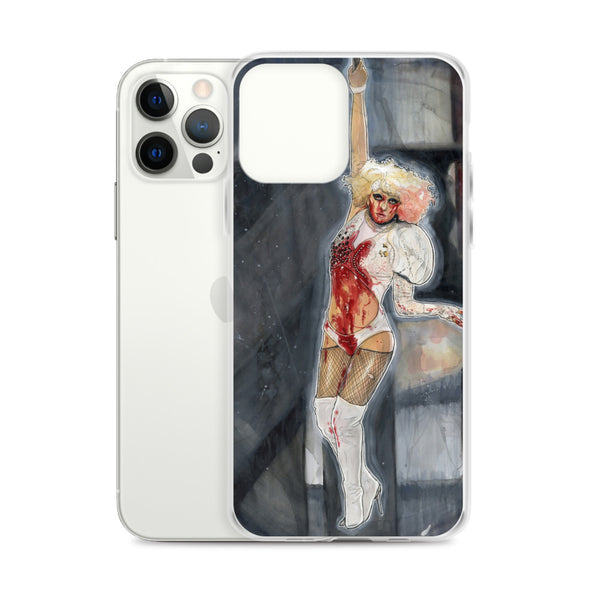 PAPARAZZI - iPhone Case