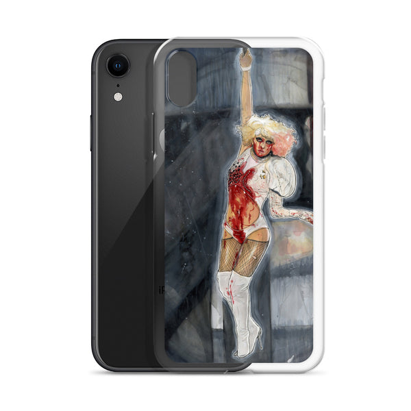 PAPARAZZI - iPhone Case